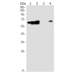 STK39 rabbit monoclonal antibody