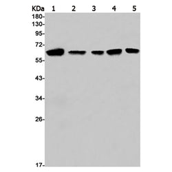 STK4 rabbit monoclonal antibody