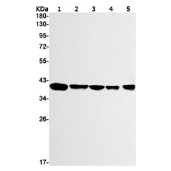 STOML2 rabbit monoclonal antibody
