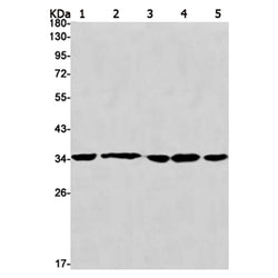 STUB1 rabbit monoclonal antibody