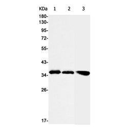 STX16 rabbit monoclonal antibody
