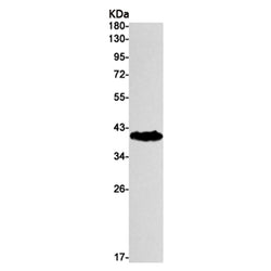 SYP rabbit monoclonal antibody