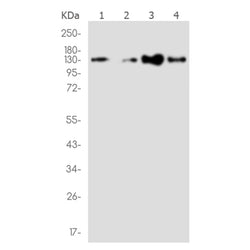TACC3 rabbit monoclonal antibody