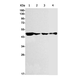 TACR1 rabbit monoclonal antibody