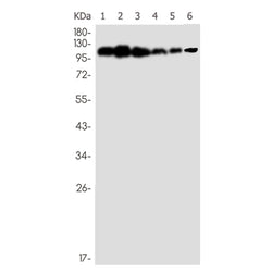 TAOK1/TAOK2/TAOK3 (phospho-Ser181/Ser181/Ser177) rabbit monoclonal antibody