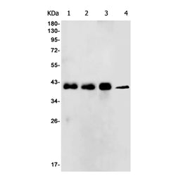 TARBP2 rabbit monoclonal antibody