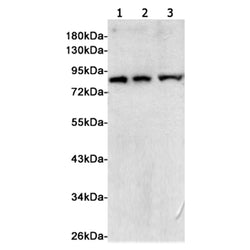 TBK1 rabbit monoclonal antibody