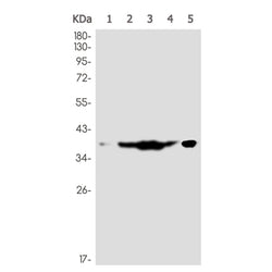 TBP rabbit monoclonal antibody
