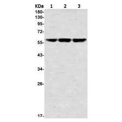TCP1 rabbit monoclonal antibody