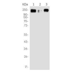 THBS1 rabbit monoclonal antibody