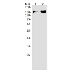 TIAM2 rabbit monoclonal antibody