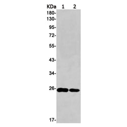 TK1 rabbit monoclonal antibody