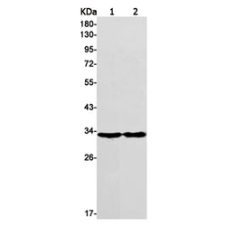 TMEM192 rabbit monoclonal antibody