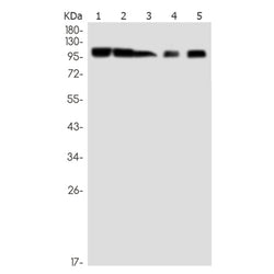 TMEM67 rabbit monoclonal antibody