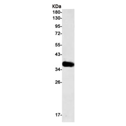 TNFRSF10D rabbit monoclonal antibody