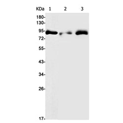 TNS4 rabbit monoclonal antibody