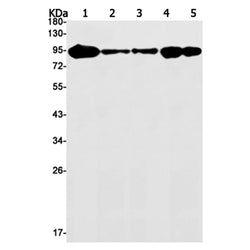 TOP1 rabbit monoclonal antibody