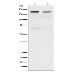 TOP2A rabbit monoclonal antibody
