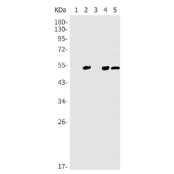 TP53 (acetyl-Lys370) rabbit monoclonal antibody