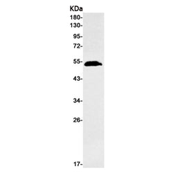 TP53 rabbit monoclonal antibody