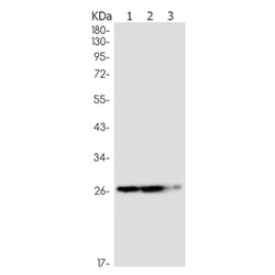 TPMT rabbit monoclonal antibody
