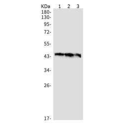 TPP1 rabbit monoclonal antibody