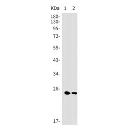 TPPP rabbit monoclonal antibody
