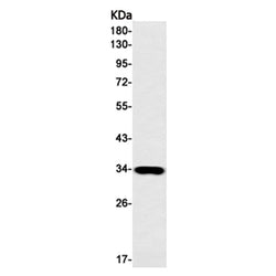 TREX1 rabbit monoclonal antibody