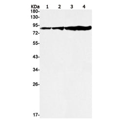 TRPV5 rabbit monoclonal antibody