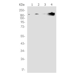 TSC2 rabbit monoclonal antibody