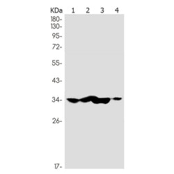 TSFM rabbit monoclonal antibody