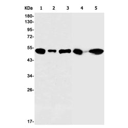 TUBA4A rabbit monoclonal antibody