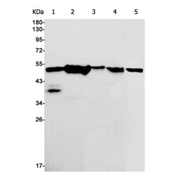 TUBB4A rabbit monoclonal antibody
