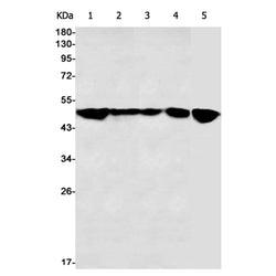 TUBG1 rabbit monoclonal antibody