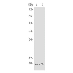 Ubiquitin rabbit monoclonal antibody