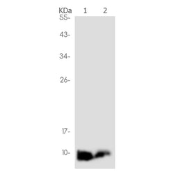 Ubiquitin K63 rabbit monoclonal antibody