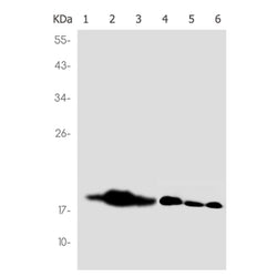 UBE2C rabbit monoclonal antibody