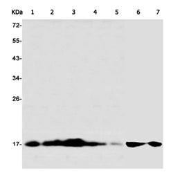 UBE2L3 rabbit monoclonal antibody