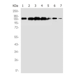 UBE4B rabbit monoclonal antibody