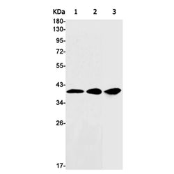 UCHL5 rabbit monoclonal antibody