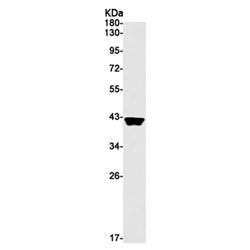 UFD1 rabbit monoclonal antibody