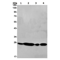 UQCRFS1 rabbit monoclonal antibody
