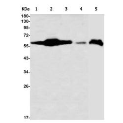 USP22 rabbit monoclonal antibody