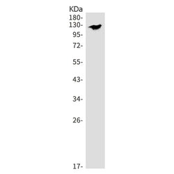 USP28 rabbit monoclonal antibody