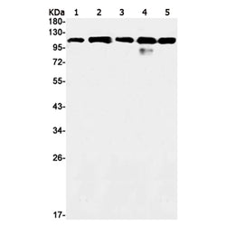 VCL rabbit monoclonal antibody