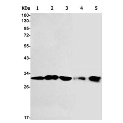 VDAC1 rabbit monoclonal antibody