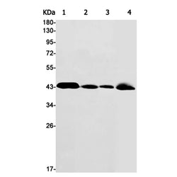 VEGFD rabbit monoclonal antibody