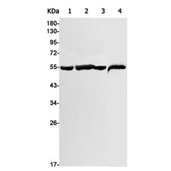 VIM rabbit monoclonal antibody