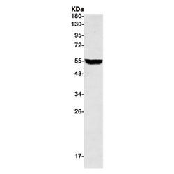 VIM (phospho-Ser56) rabbit monoclonal antibody