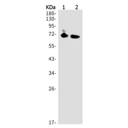 VTCN1 rabbit monoclonal antibody